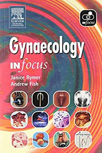 Gynaecology focus paperback - in,